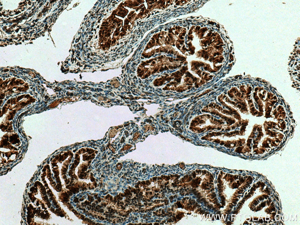 Immunohistochemistry (IHC) staining of mouse ovary tissue using GLIS1 Polyclonal antibody (23138-1-AP)