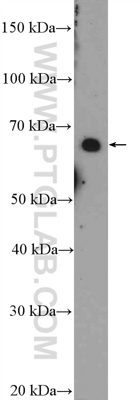 Western Blot (WB) analysis of Jurkat cells using GLIS1 Polyclonal antibody (23138-1-AP)