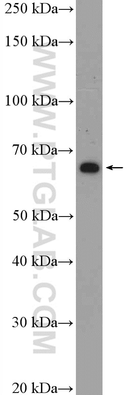 Western Blot (WB) analysis of Jurkat cells using GLIS1 Polyclonal antibody (23138-1-AP)