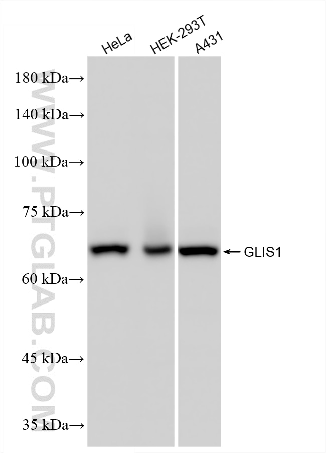 WB analysis using 86902-1-RR Western Blot (WB) analysis of various lysates using GLIS1 Recombinant monoclonal antibody (86902-1-RR)