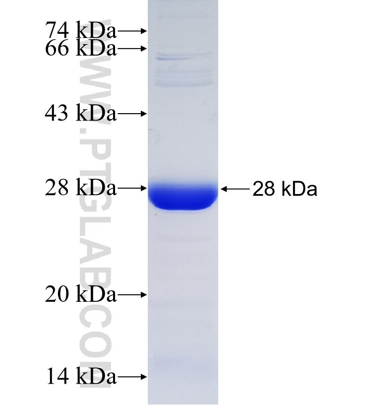 GLIS2 fusion protein Ag33852 SDS-PAGE GLIS2 fusion protein Ag33852 SDS-PAGE