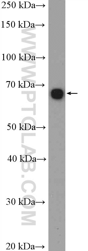 Western Blot (WB) analysis of A549 cells using GLIS3 Polyclonal antibody (12678-1-AP)