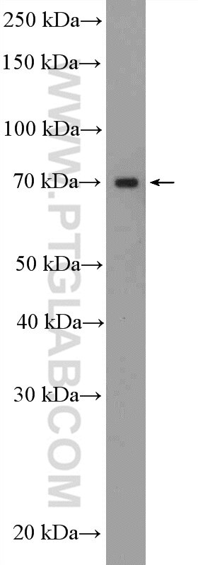 WB analysis of BxPC-3 using 12678-1-AP