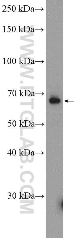 Western Blot (WB) analysis of HepG2 cells using GLIS3 Polyclonal antibody (12678-1-AP)