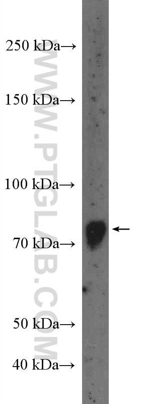 Western Blot (WB) analysis of mouse kidney tissue using GLIS3 Polyclonal antibody (12678-1-AP)