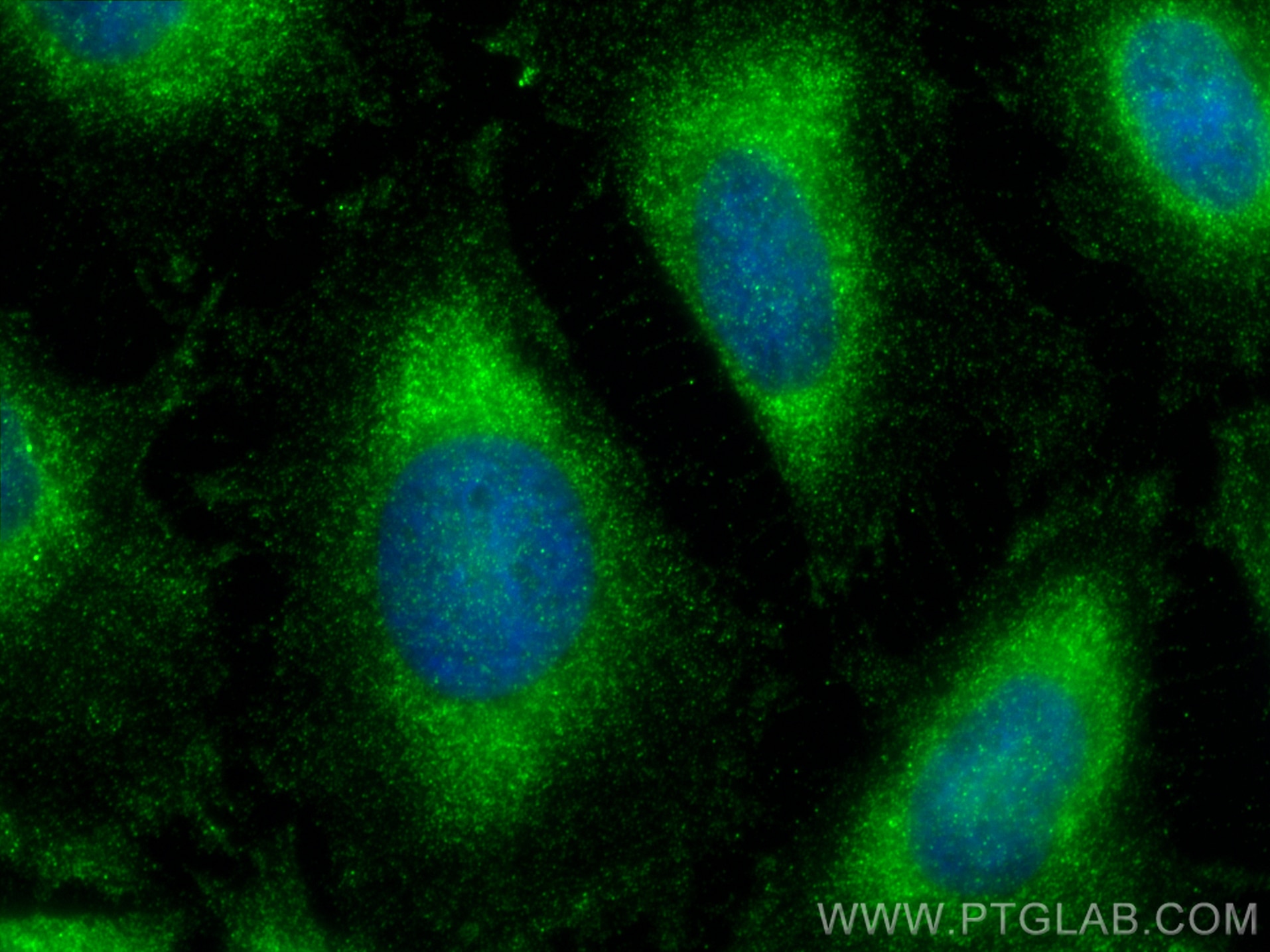 Immunofluorescence (IF) / fluorescent staining of HeLa cells using GLMN Polyclonal antibody (32645-1-AP)