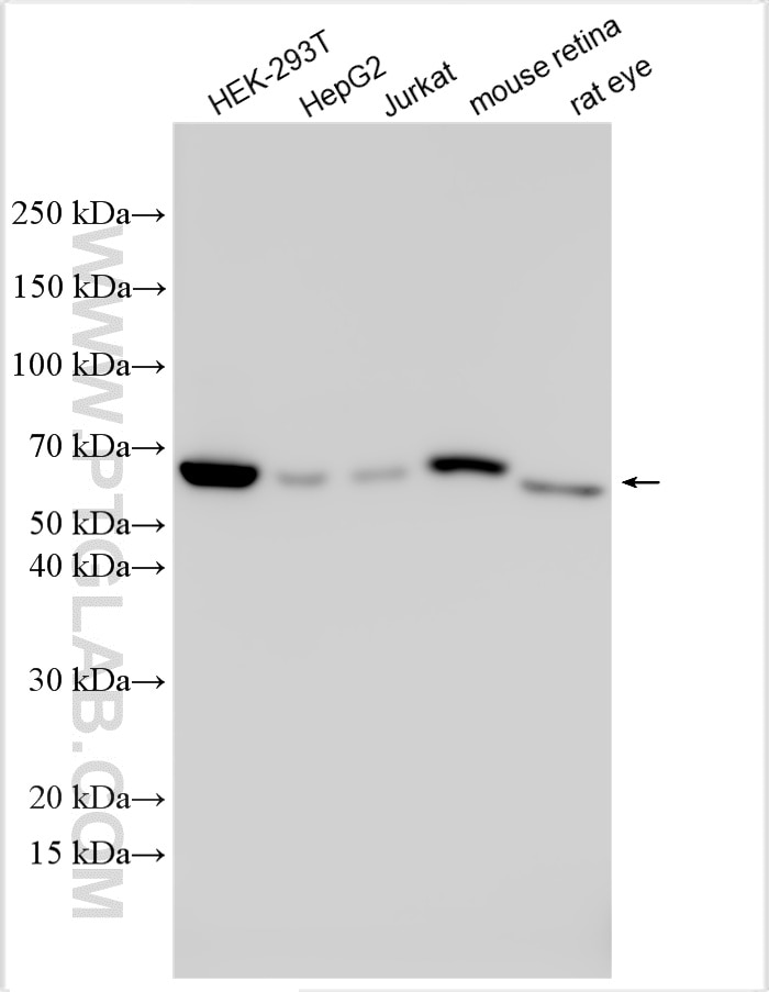 Western Blot (WB) analysis of various lysates using GLMN Polyclonal antibody (32645-1-AP)