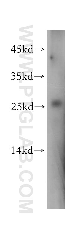 Western Blot (WB) analysis of HeLa cells using GLO1 Polyclonal antibody (18477-1-AP)