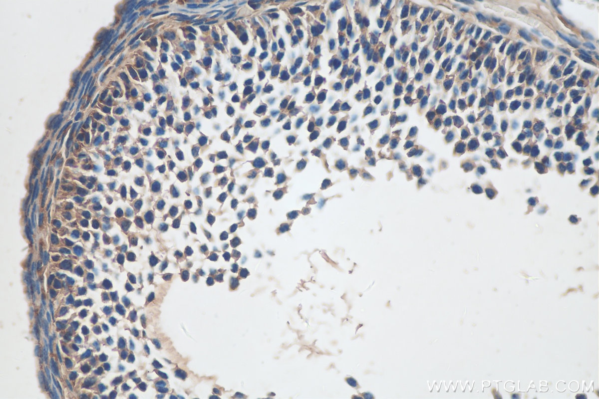 Immunohistochemistry (IHC) staining of mouse ovary tissue using GLOD4 Polyclonal antibody (16788-1-AP)