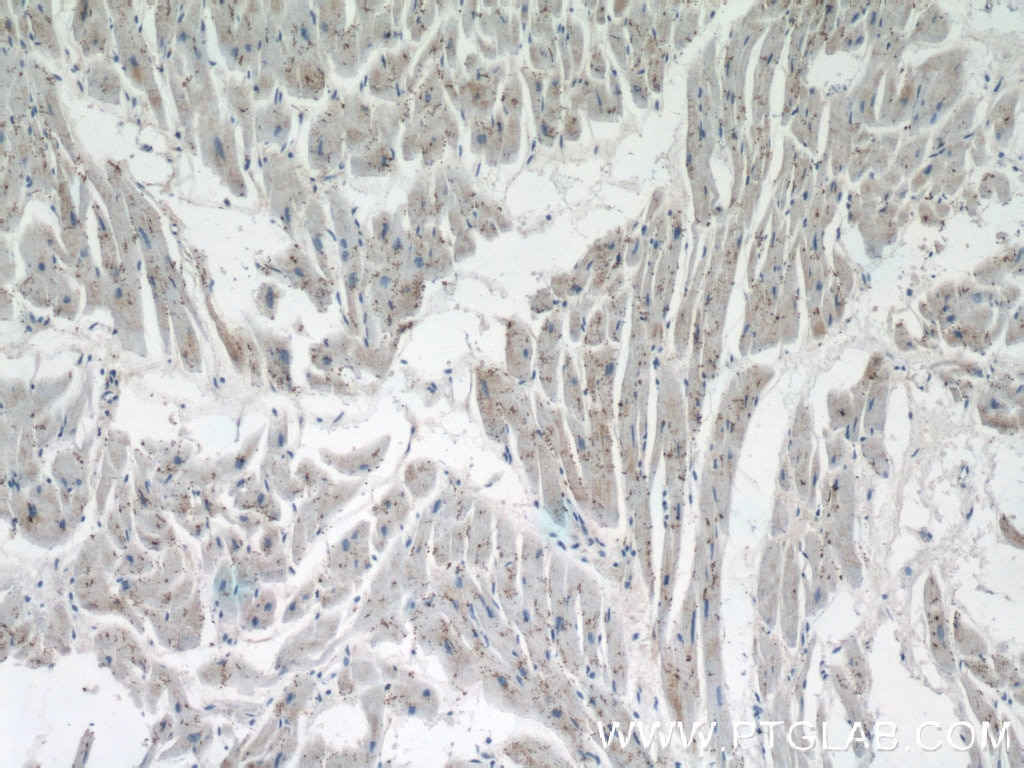 Immunohistochemistry (IHC) staining of human heart tissue using GLOD4 Polyclonal antibody (16788-1-AP)