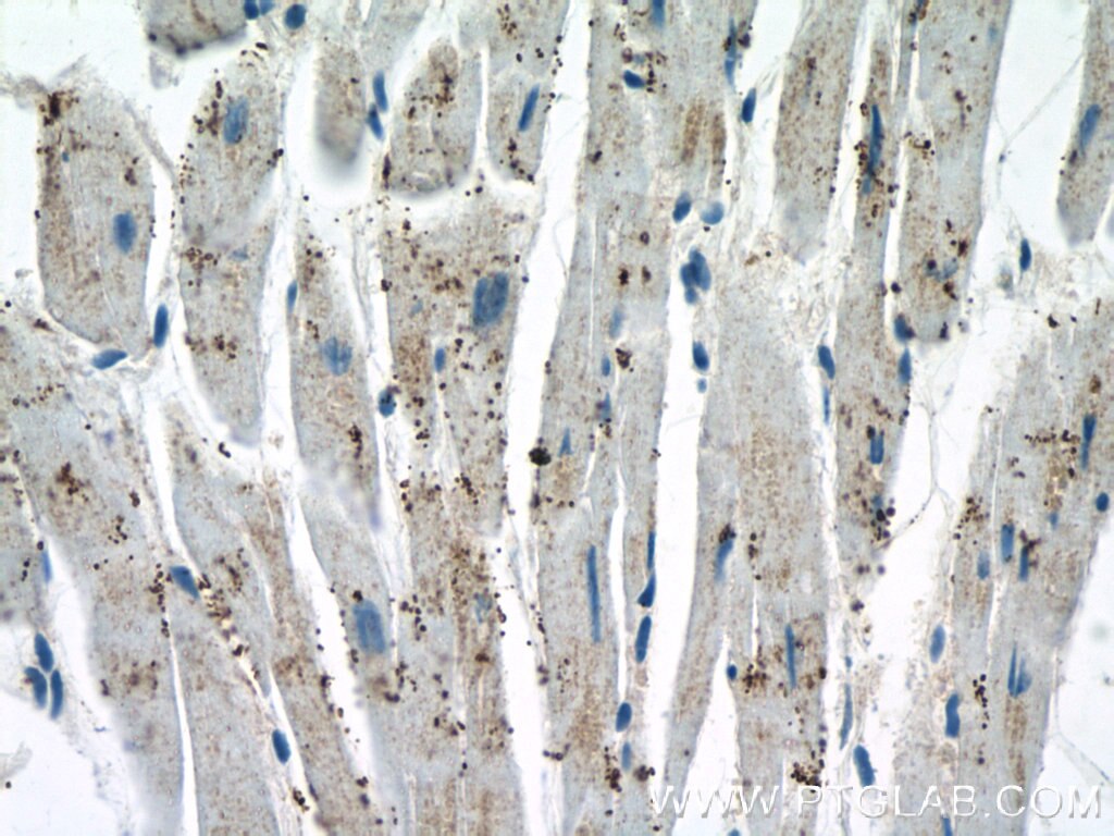 Immunohistochemistry (IHC) staining of human heart tissue using GLOD4 Polyclonal antibody (16788-1-AP)
