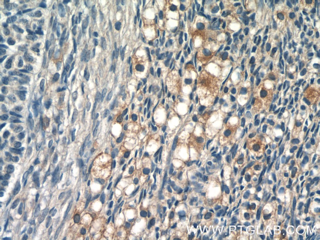 Immunohistochemistry (IHC) staining of human ovary tissue using GLOD4 Polyclonal antibody (16788-1-AP)