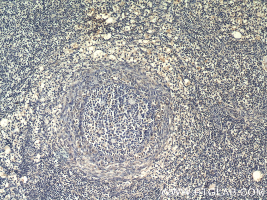Immunohistochemistry (IHC) staining of human ovary tissue using ZGLP1 Polyclonal antibody (55292-1-AP)