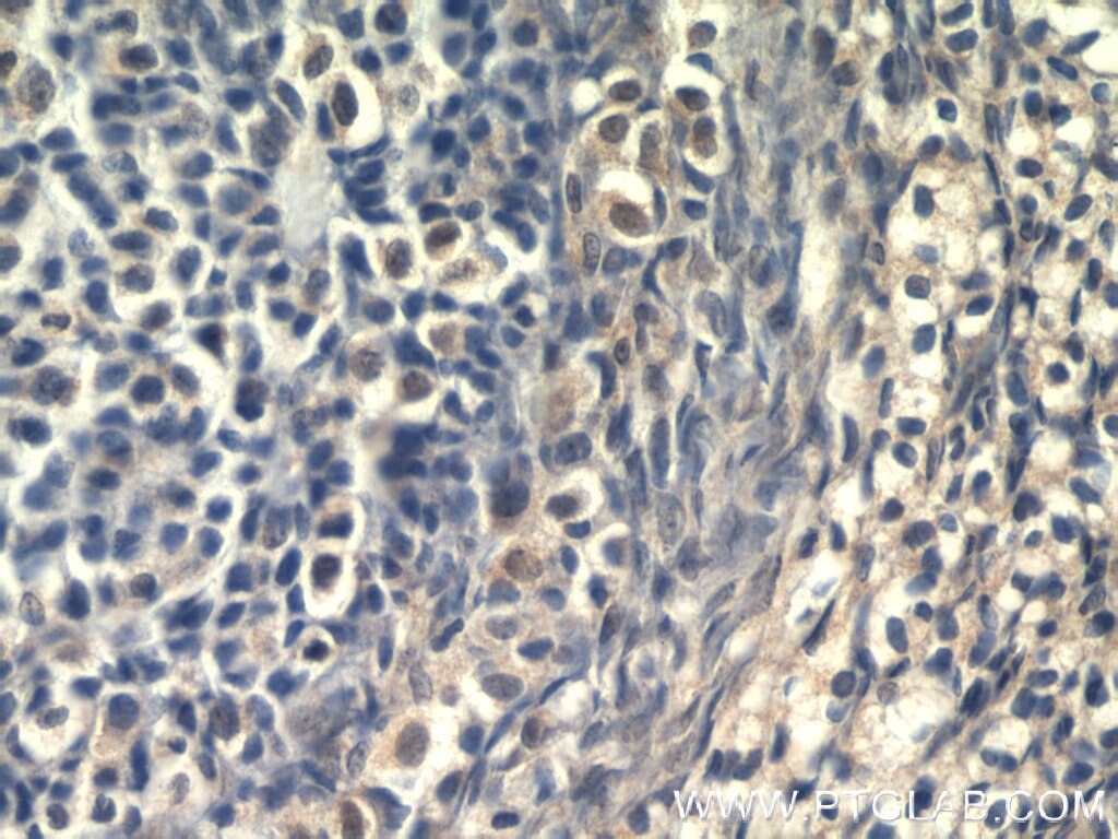 IHC staining of human ovary using 55292-1-AP