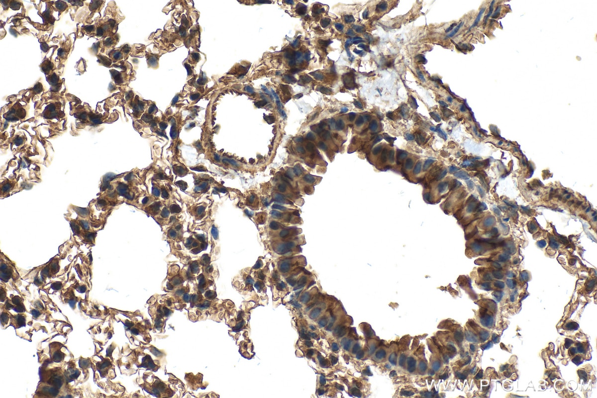 Immunohistochemistry (IHC) staining of mouse lung tissue using GLP1R Polyclonal antibody (26196-1-AP)