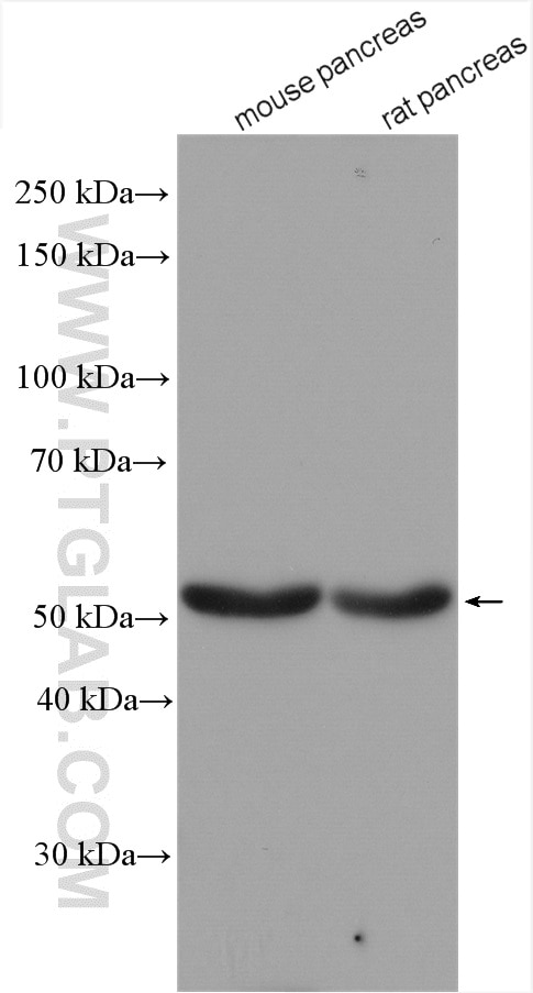 Western Blot (WB) analysis of various lysates using GLP1R Polyclonal antibody (26196-1-AP)