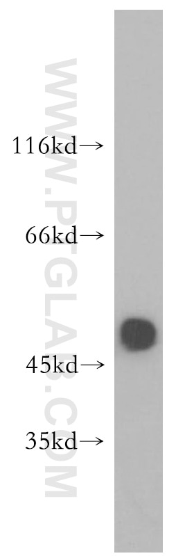 Western Blot (WB) analysis of mouse brain tissue using GLRA1 Polyclonal antibody (17951-1-AP)