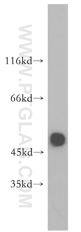 WB analysis of mouse brain using 17951-1-AP