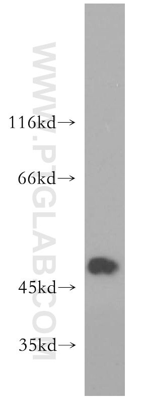 WB analysis of mouse cerebellum using 17951-1-AP