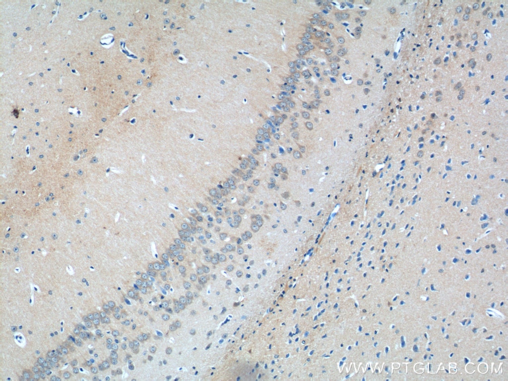 Immunohistochemistry (IHC) staining of mouse brain tissue using GLRA2 Polyclonal antibody (13831-1-AP)