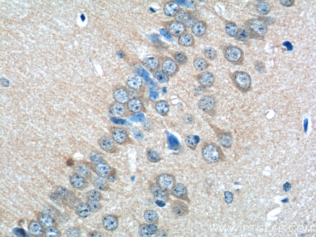 Immunohistochemistry (IHC) staining of mouse brain tissue using GLRA2 Polyclonal antibody (13831-1-AP)