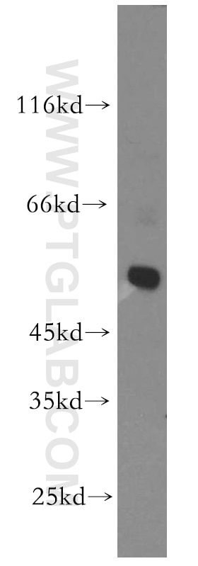Western Blot (WB) analysis of MCF-7 cells using GLRA3 Polyclonal antibody (13145-1-AP)