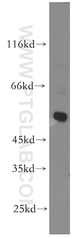 WB analysis of MCF-7 using 13145-1-AP