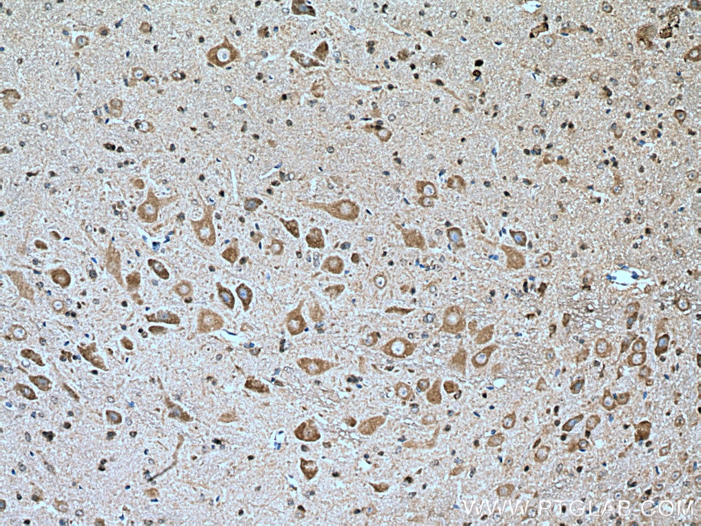 Immunohistochemistry (IHC) staining of mouse cerebellum tissue using GLRB Polyclonal antibody (15371-1-AP)