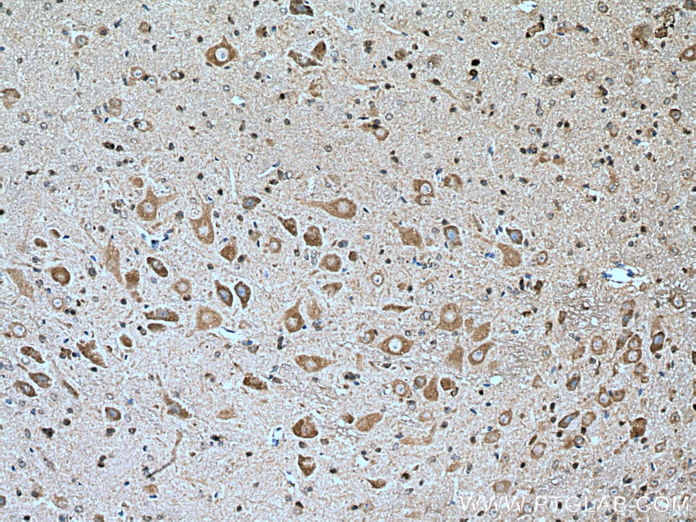 IHC staining of mouse cerebellum using 15371-1-AP