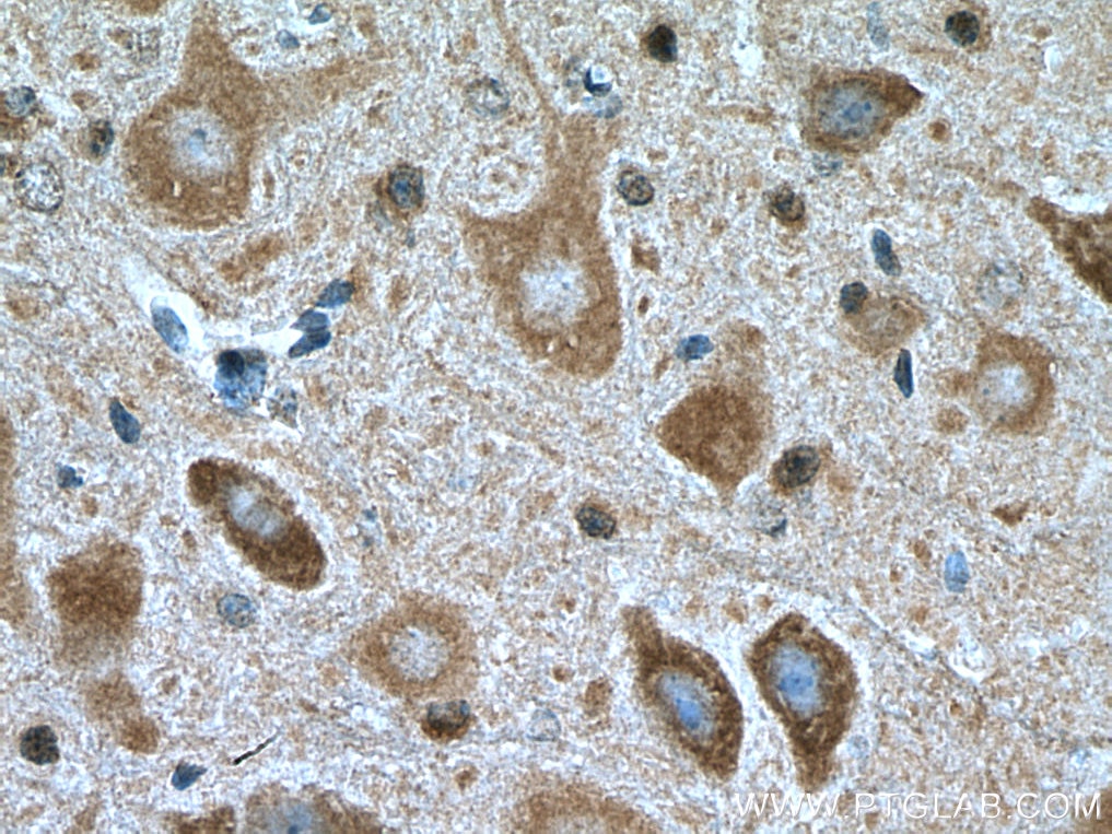 Immunohistochemistry (IHC) staining of mouse cerebellum tissue using GLRB Polyclonal antibody (15371-1-AP)