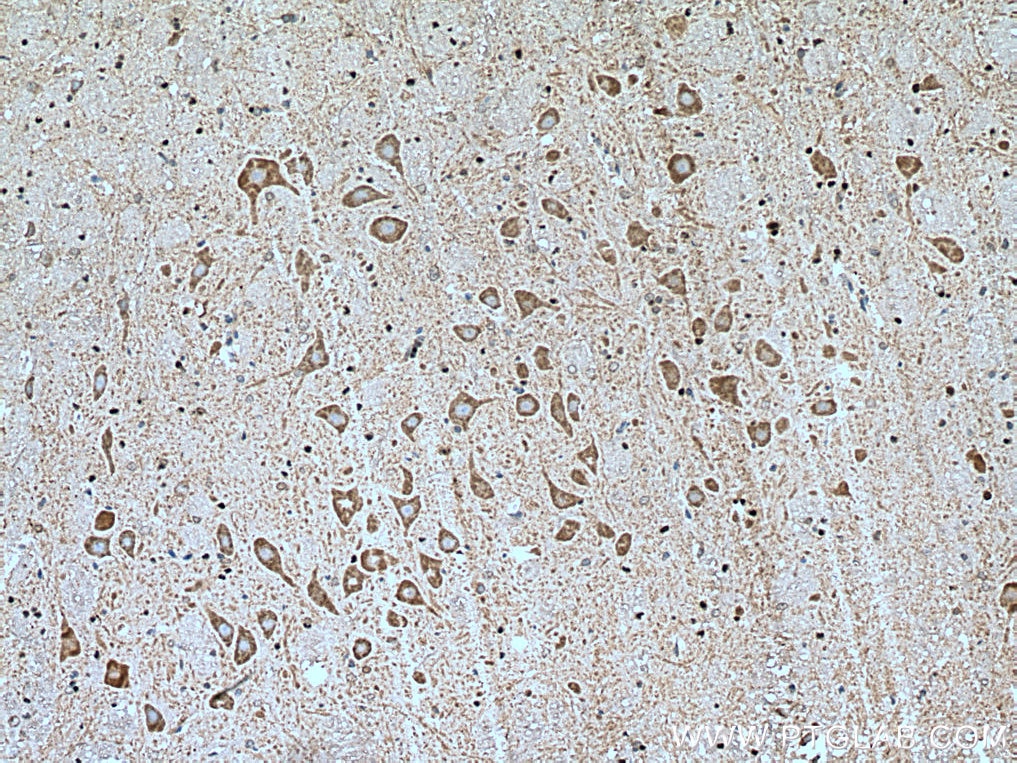 Immunohistochemistry (IHC) staining of rat cerebellum tissue using GLRB Polyclonal antibody (15371-1-AP)
