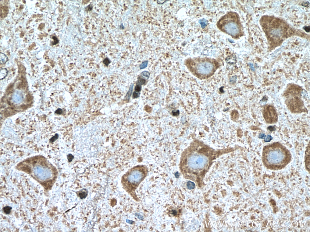 Immunohistochemistry (IHC) staining of rat cerebellum tissue using GLRB Polyclonal antibody (15371-1-AP)