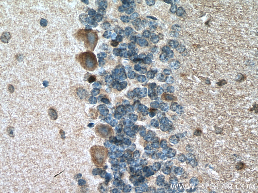 Immunohistochemistry (IHC) staining of mouse cerebellum tissue using GLRB Polyclonal antibody (15371-1-AP)