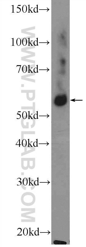 Western Blot (WB) analysis of mouse spinal cord tissue using GLRB Polyclonal antibody (15371-1-AP)
