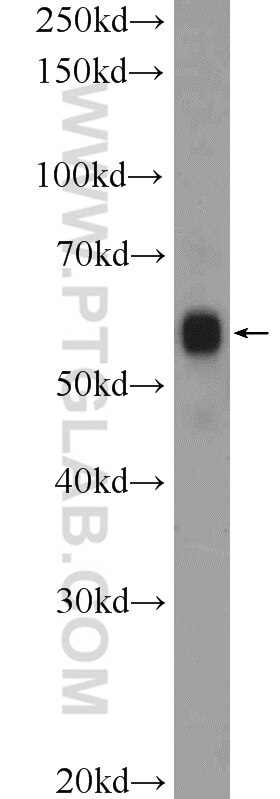 Western Blot (WB) analysis of mouse brain tissue using GLRB Polyclonal antibody (15371-1-AP)