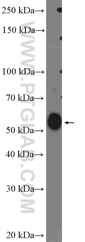 Western Blot (WB) analysis of rat brain tissue using GLRB Polyclonal antibody (15371-1-AP)