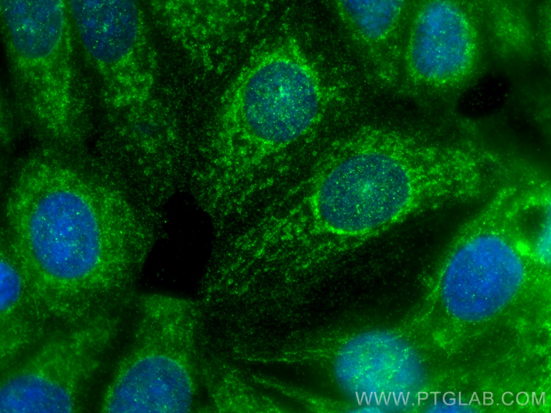 Immunofluorescence (IF) / fluorescent staining of MCF-7 cells using GLRX2 Polyclonal antibody (13381-1-AP)
