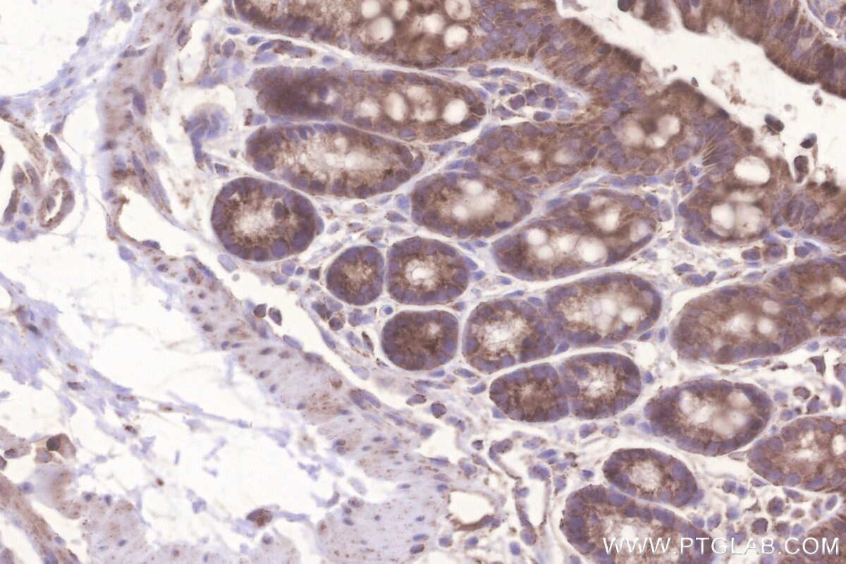 IHC staining of mouse colon using 18884-1-AP Immunohistochemistry (IHC) staining of mouse colon tissue using Glutaredoxin 5 Polyclonal antibody (18884-1-AP)