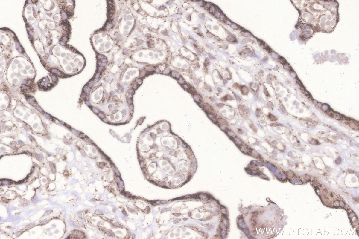IHC staining of human placenta using 18884-1-AP Immunohistochemistry (IHC) staining of human placenta tissue using Glutaredoxin 5 Polyclonal antibody (18884-1-AP)