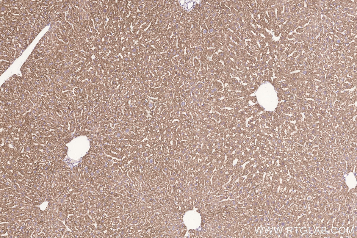 IHC staining of mouse liver using 18884-1-AP Immunohistochemistry (IHC) staining of mouse liver tissue using Glutaredoxin 5 Polyclonal antibody (18884-1-AP)