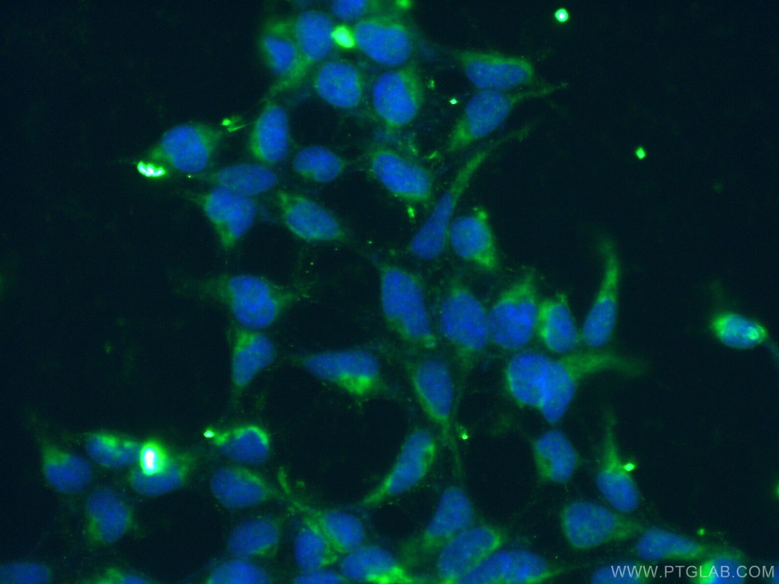 Immunofluorescence (IF) / fluorescent staining of HEK-293 cells using KGA/GAC Polyclonal antibody (12855-1-AP)