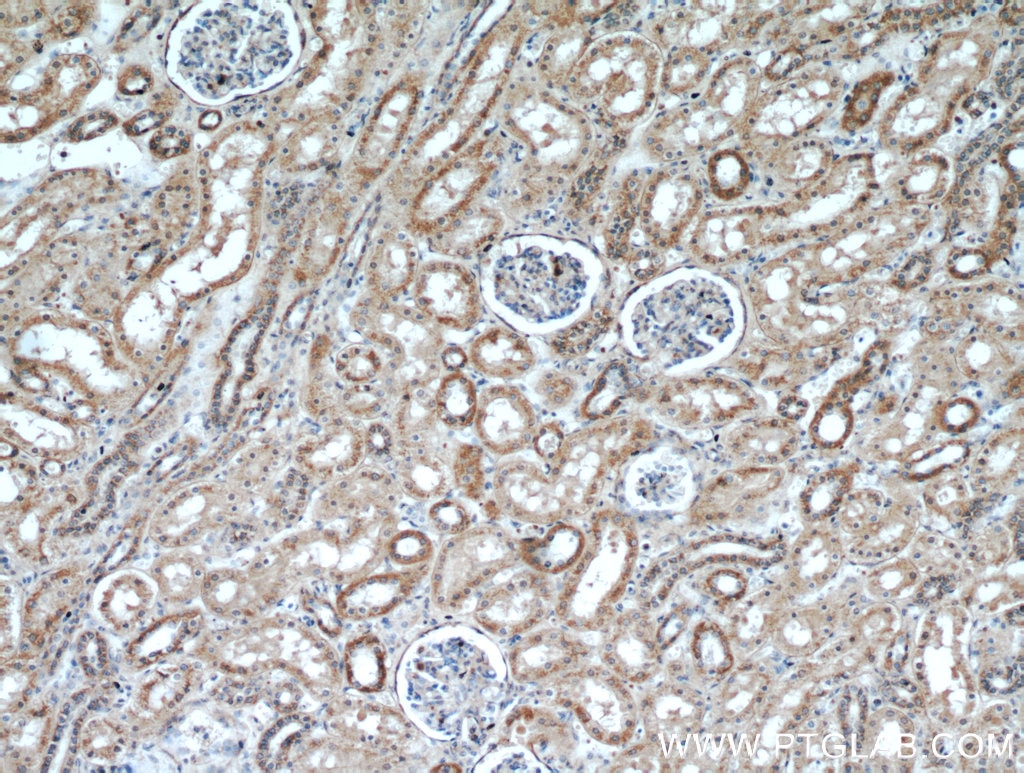 Immunohistochemistry (IHC) staining of human kidney tissue using KGA/GAC Polyclonal antibody (12855-1-AP)