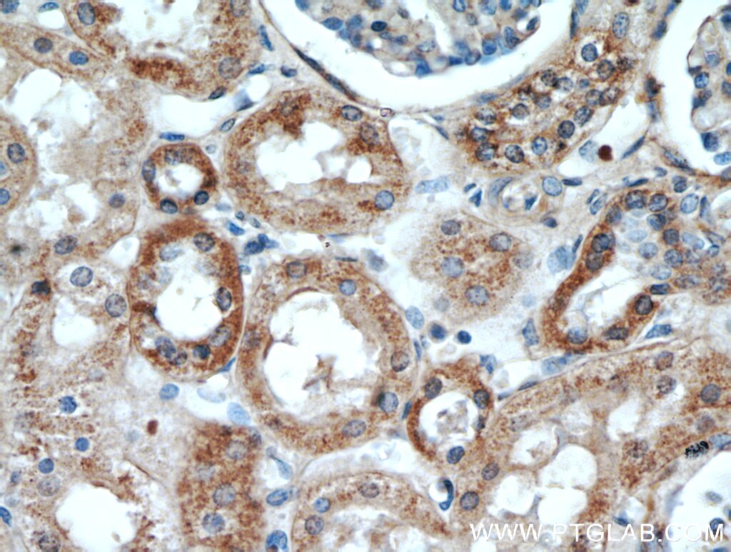 Immunohistochemistry (IHC) staining of human kidney tissue using KGA/GAC Polyclonal antibody (12855-1-AP)