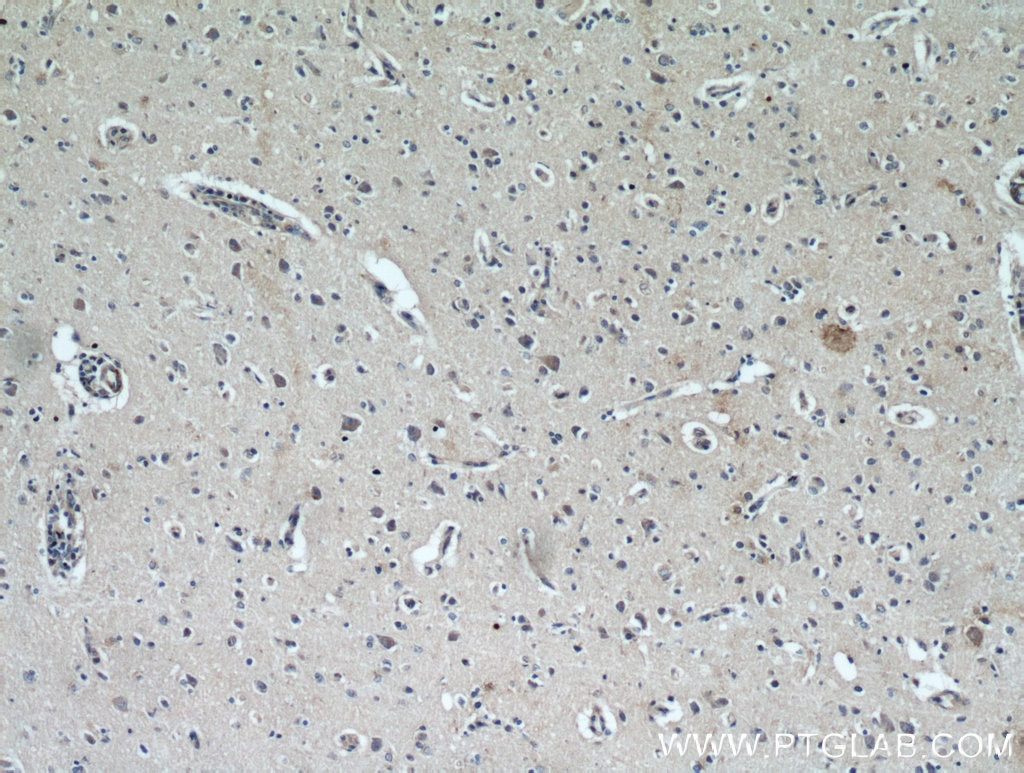 Immunohistochemistry (IHC) staining of human brain tissue using KGA/GAC Polyclonal antibody (12855-1-AP)