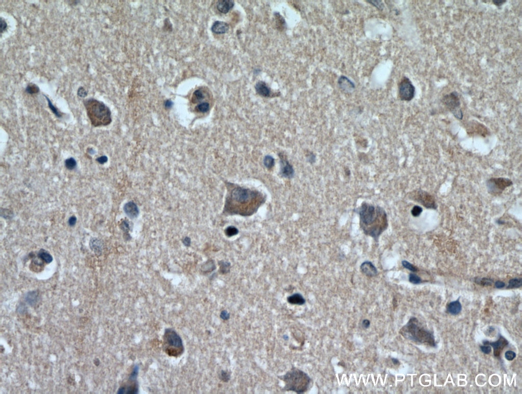 Immunohistochemistry (IHC) staining of human brain tissue using KGA/GAC Polyclonal antibody (12855-1-AP)