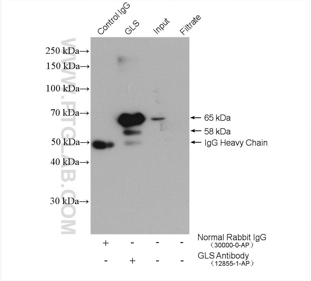 Immunoprecipitation (IP) experiment of mouse brain tissue using KGA/GAC Polyclonal antibody (12855-1-AP)