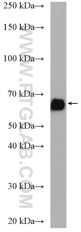 Western Blot (WB) analysis of mouse brain tissue using KGA/GAC Polyclonal antibody (12855-1-AP)