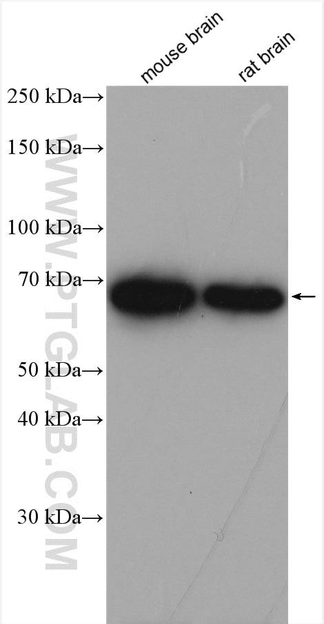 Western Blot (WB) analysis of various lysates using KGA/GAC Polyclonal antibody (12855-1-AP)