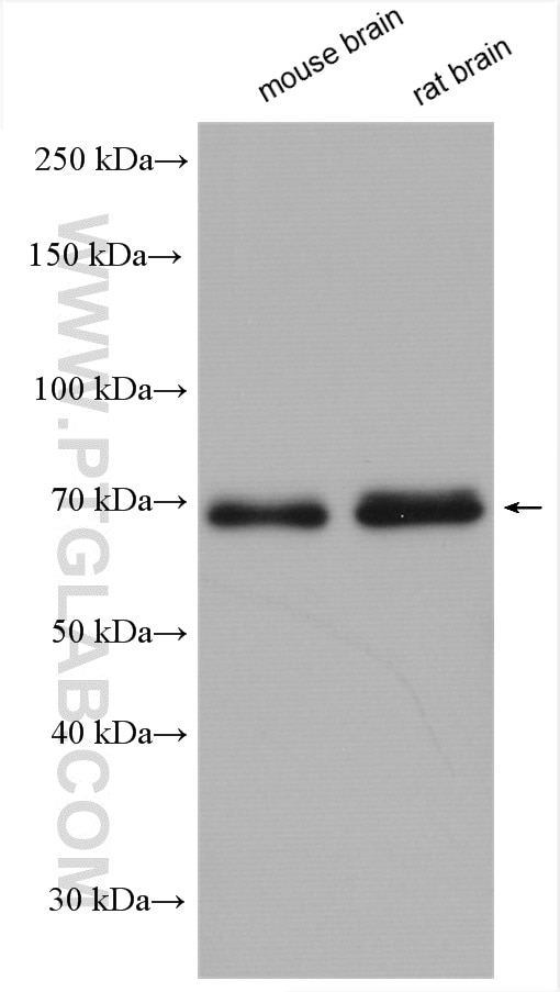 Western Blot (WB) analysis of various lysates using KGA/GAC Polyclonal antibody (12855-1-AP)