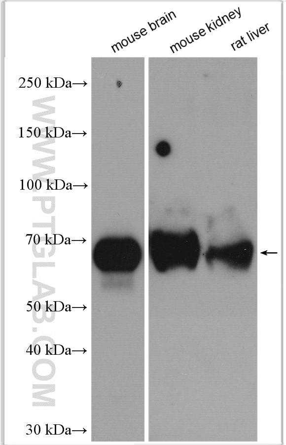 Western Blot (WB) analysis of various lysates using KGA/GAC Polyclonal antibody (12855-1-AP)